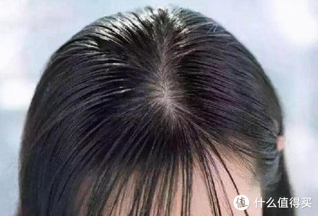 头发爱出油怎么治？远离11大头发护理危害误区