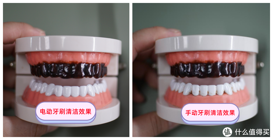电动牙刷会不会损坏牙齿？揭露三大内幕危害！