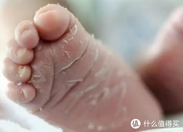 宝宝出生后为什么会脱皮？怎么护理宝宝的皮肤都告诉你了，别错过