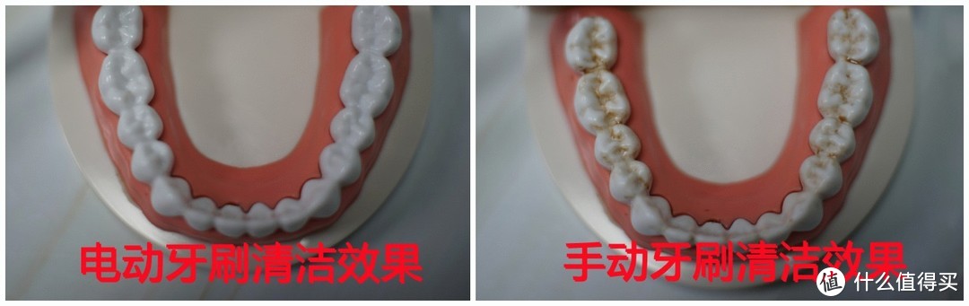 电动牙刷伤牙吗？三大弊病危害汇总，注意规避！
