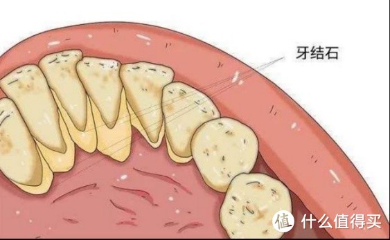 电动牙刷是智商税吗？星际悦动usmile笑容加电动牙刷测评!