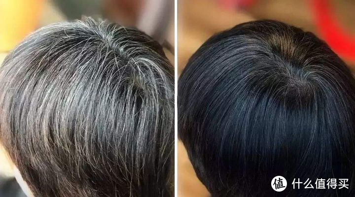 如何改善白发变黑发？12大头发养护技巧汇总，必看！