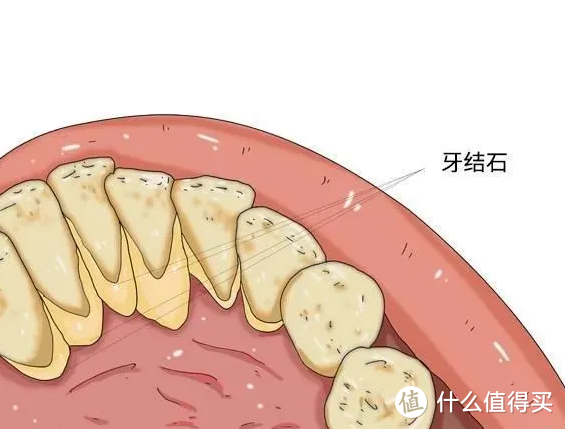 【不走弯路冲牙器测评分享】超全面冲牙器测评：扉乐、洁碧、松下、素士、力博得等详细对比