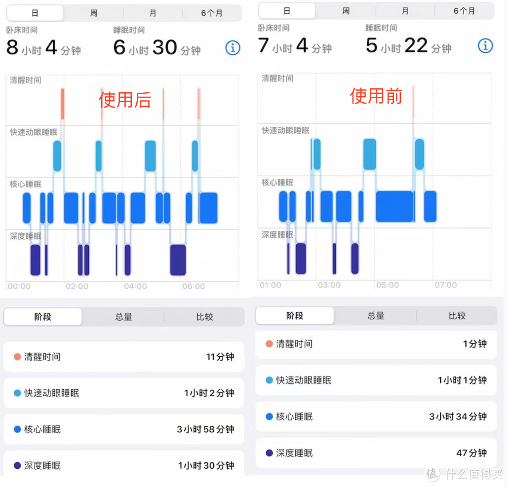 AGExper保卫先生负离子助眠机X1——提升睡眠质量，远离焦虑失眠