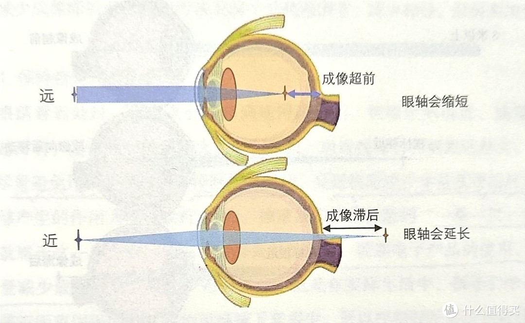 孩子近视了,该不该配镜,配什么样的眼镜?近视防控这样做,才真的有效!