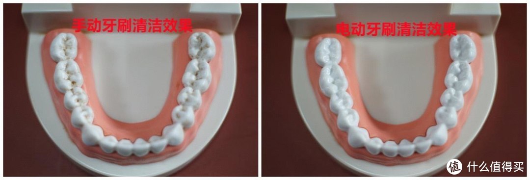 电动牙刷会对牙齿造成伤害吗？慎防四大雷区潜规则！