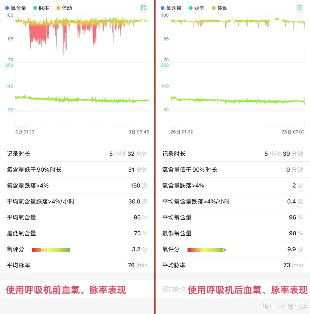 夫妻分床睡半年，为了解决打鼾问题，我买了乐普R20呼吸机