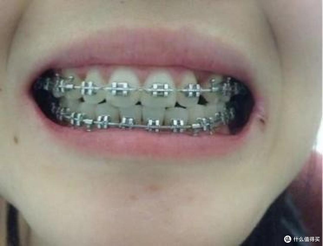 冲牙器推荐攻略,如何选购性价比高的冲牙器?看完这篇就够了,13款热门冲牙器真实测评分析。