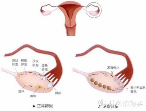 42岁女子20天断崖式衰老？卵巢对女人有什么作用怎么保养卵巢