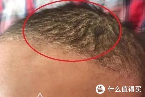 “宝宝头发越来越少了”，消失的头发去哪了？了解一下婴儿掉头发