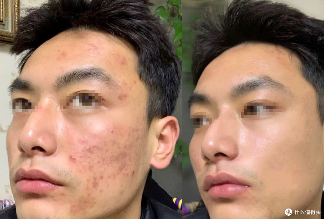 恢复成这样，感觉找对象应该更有希望了吧