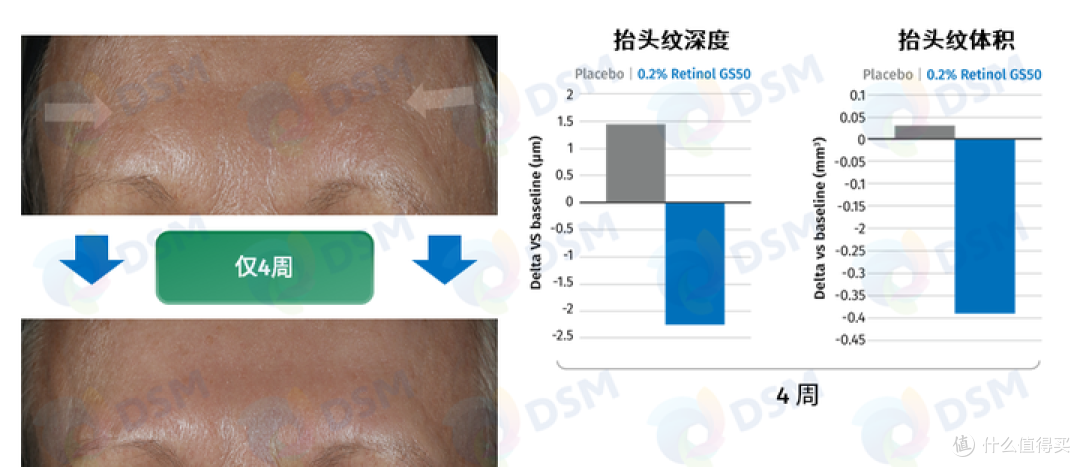 2024男士面霜段位榜推荐 【配方师揭秘】秋冬男生脸上爆皮、泛红、暗沉、长痘，选这9款男士面霜就够了！
