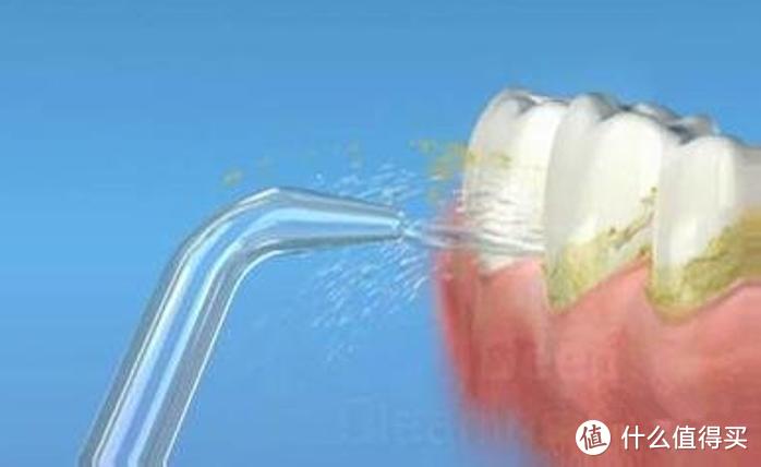 正畸牙齿矫正能用冲牙器吗？三大雷区弊病须知！