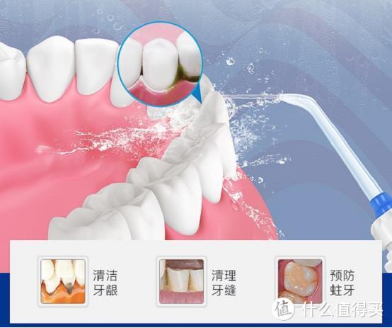 牙周炎能用冲牙器吗？警告四大圈套危害！