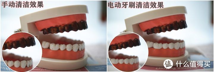 用电动牙刷对牙齿有伤害吗？三大弊病槽点须小心！