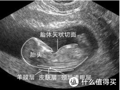 怀孕为什么要产检，整个孕期一共要产检多少次？一文说清楚