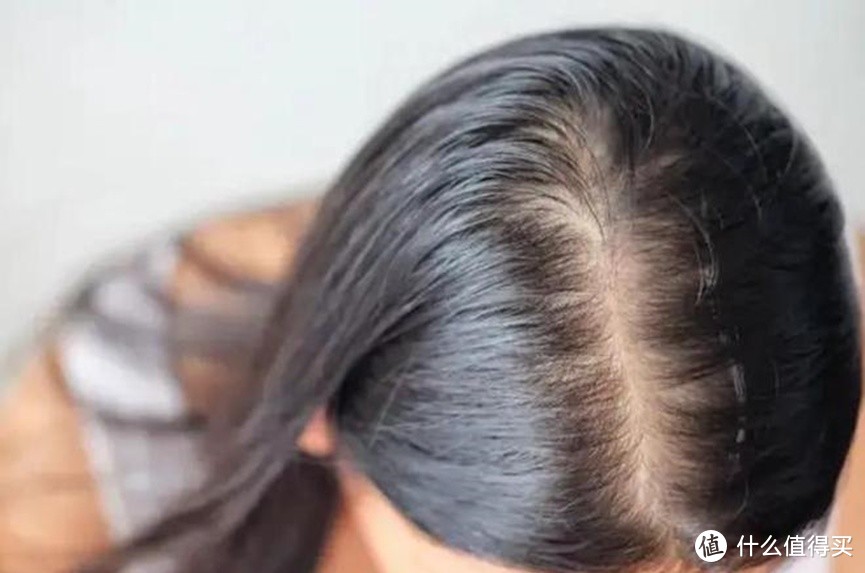 头发稀疏有什么办法让头发变浓密？秘传13大护理方法！ 