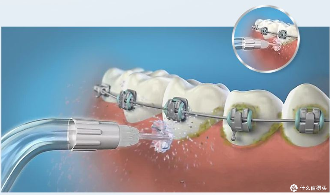 冲牙器十大品牌排行榜:十款超理想品牌,2024闭眼入