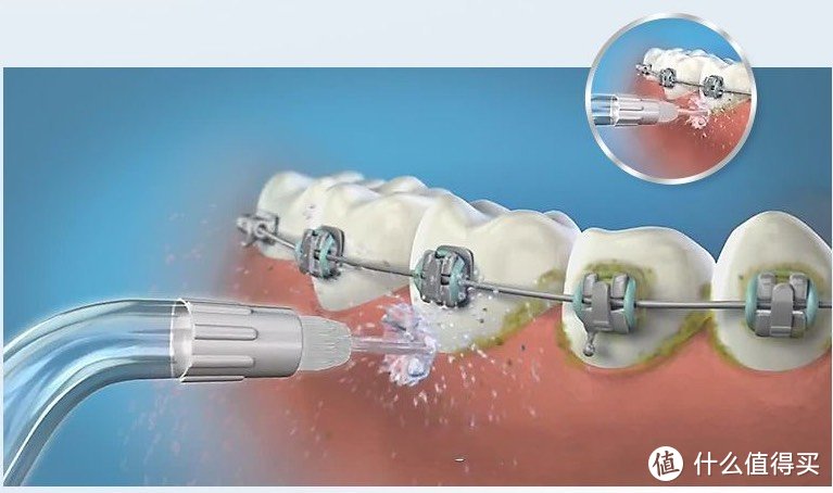 十大冲牙器品牌：十款全网高评品牌，2024全力推荐