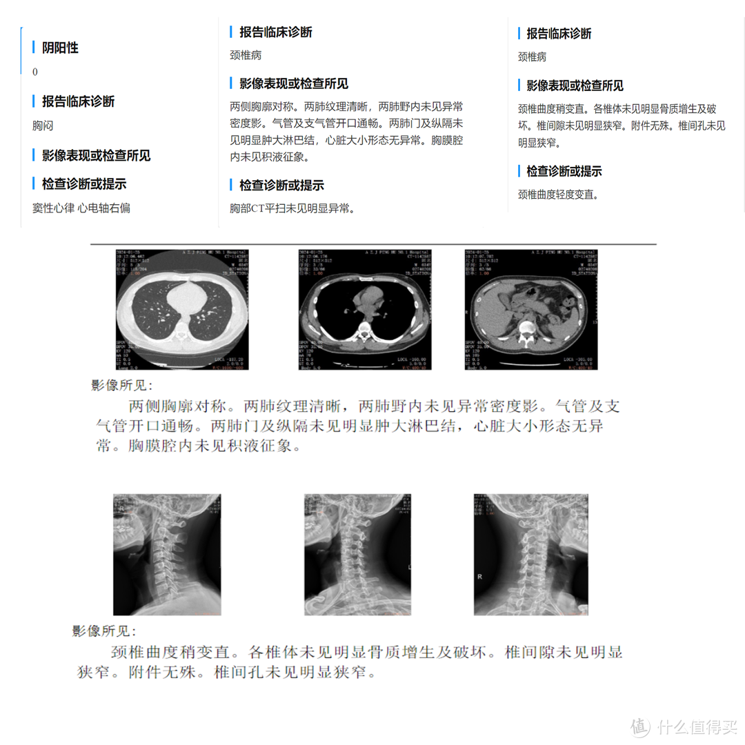 摩伽S3 Plus  极客版 滑越追背全时支撑——颈椎问题病友的众测体验