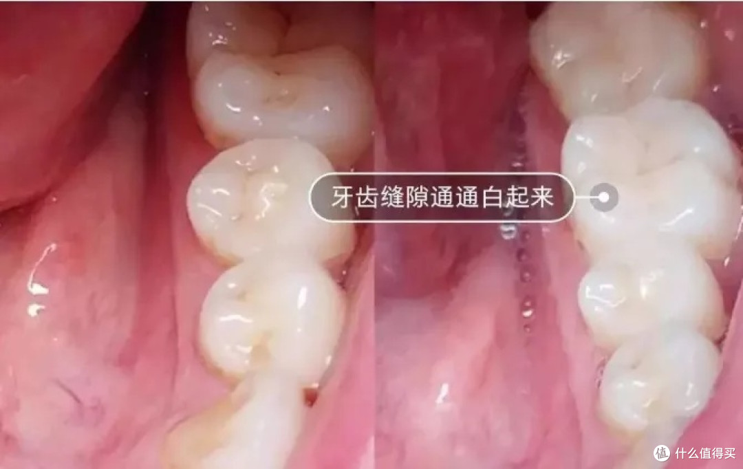 忠告三大智商税危害!_洁牙用具_什么值得买