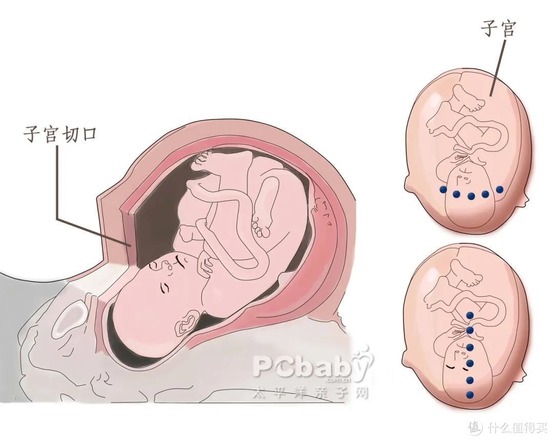 生孩子痛苦是进化的bug吗？