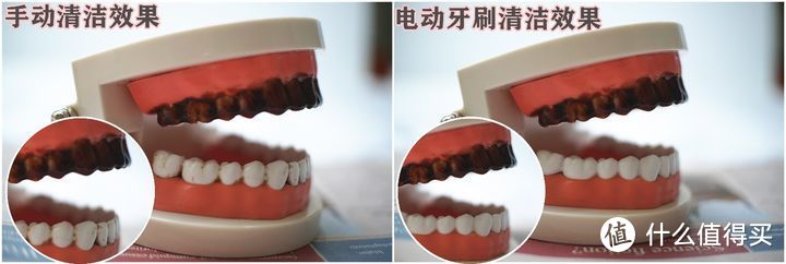 电动牙刷会刷坏牙齿吗？三大副作用弊病千万警惕