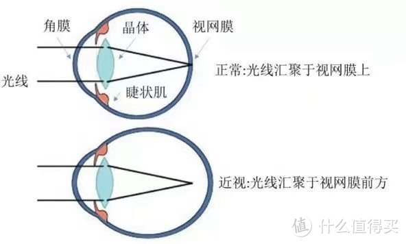 聊聊关于眼部健康问题~