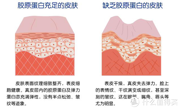 人源Ⅲ型胶原蛋白| 详细介绍、使用方法、注意事项