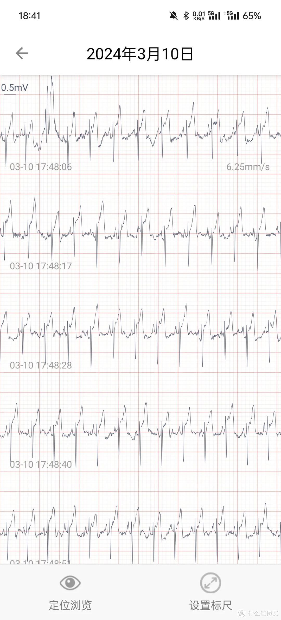 测评报告｜乐普ER1—医疗级家用心电监测设备使用体验