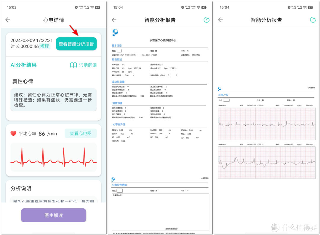 阳康后常出现心悸心慌？家用心电仪——24小时的健康守护神