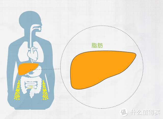 从“脂肪肝”到“肝癌”，只有四步，越早知道越好——全国爱肝日