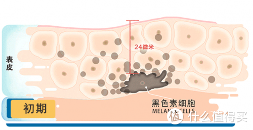 选对产品：祛斑效果最好的排名第一，祛斑省劲了！
