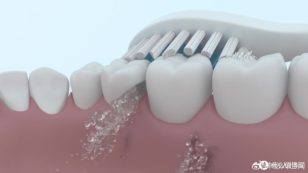 电动牙刷会对牙齿造成伤害吗？三大内幕害处须警惕