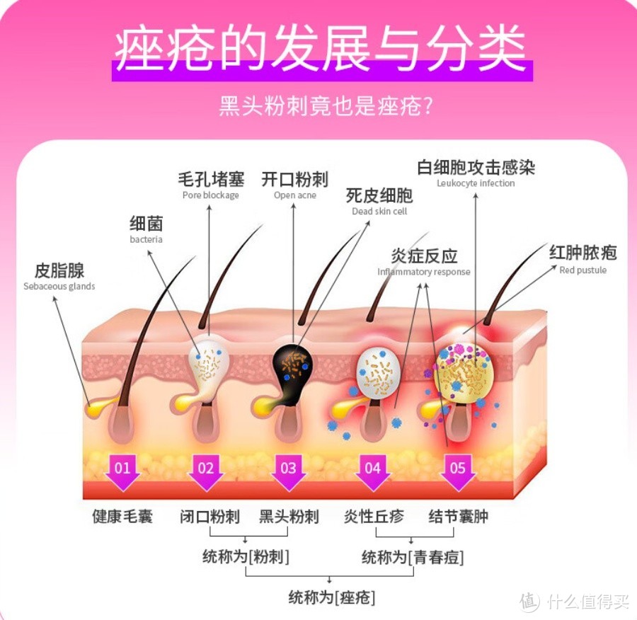 告别粉刺，阿达帕林凝胶的神奇效果！