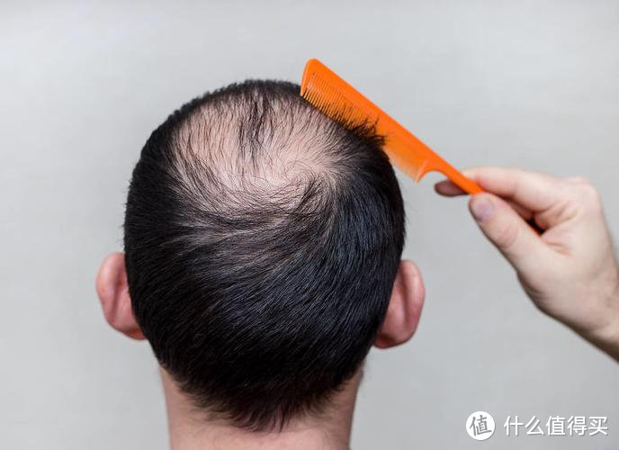头顶头发稀疏怎么恢复？警告12大头发护理陷阱害处！