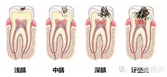 坚信牙线撬动地球，小鹿妈妈牙线以身作则引领健康口腔生活