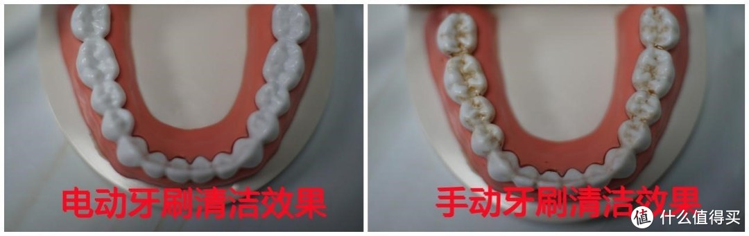 补过的牙能用电动牙刷吗？扫振、旋转、声波式害处详解