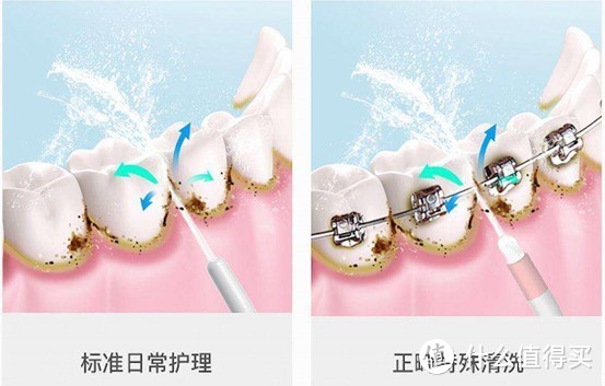 正畸牙齿矫正能用冲牙器吗？起底四类黑幕槽点！