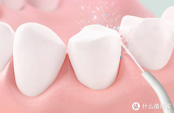 冲牙器伤害牙齿吗？三大弊病风险须严防！