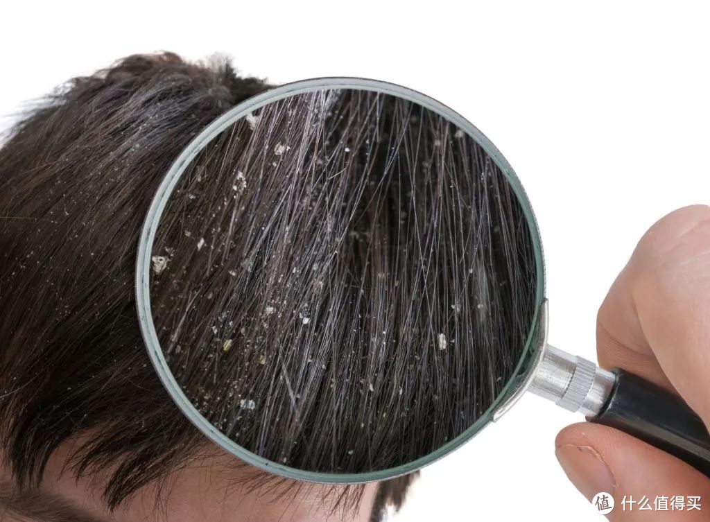 真实经验分享！养发半年，洗发+护发一网打尽，从此告别头屑、干枯毛躁、小疙瘩！