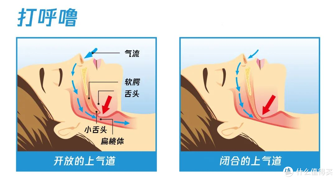 Nitetronic 添眠智能止鼾枕|消除打鼾，俩人好睡眠，“幸福肥”两口子的睡眠质量保卫战！