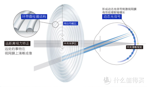 蔡司小乐圆镜片，让孩子近视管理“无死角”！