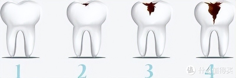 牙医推荐冲牙器吗？3大缺陷误区爆料！