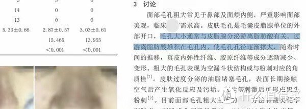 毛孔粗大和什么有关系？怎么解决？