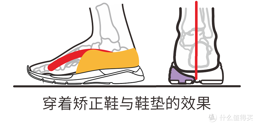 儿童矫正鞋选购全攻略：从验脚到穿着，一文全告诉你！