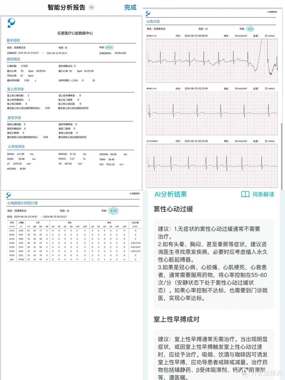 从心跳读懂健康