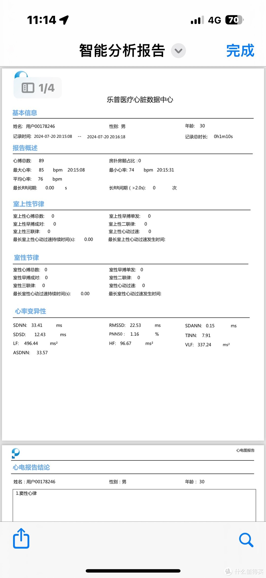 送家人一份“心安”，入手乐普ER2-S心电记录仪，时时刻刻关注心脏健康！