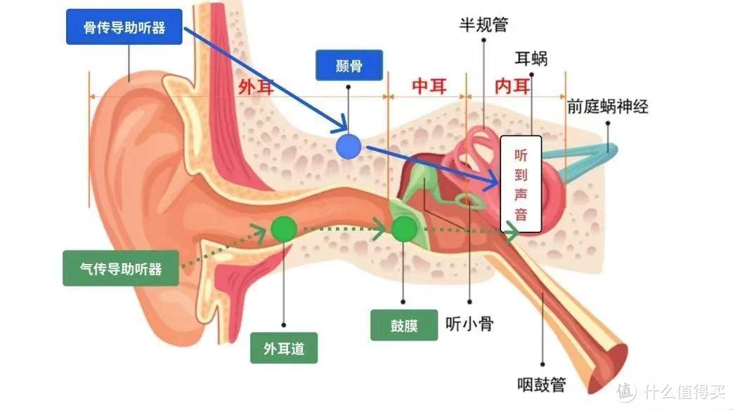 zdeer左点骨传导助听器，科技改变生活