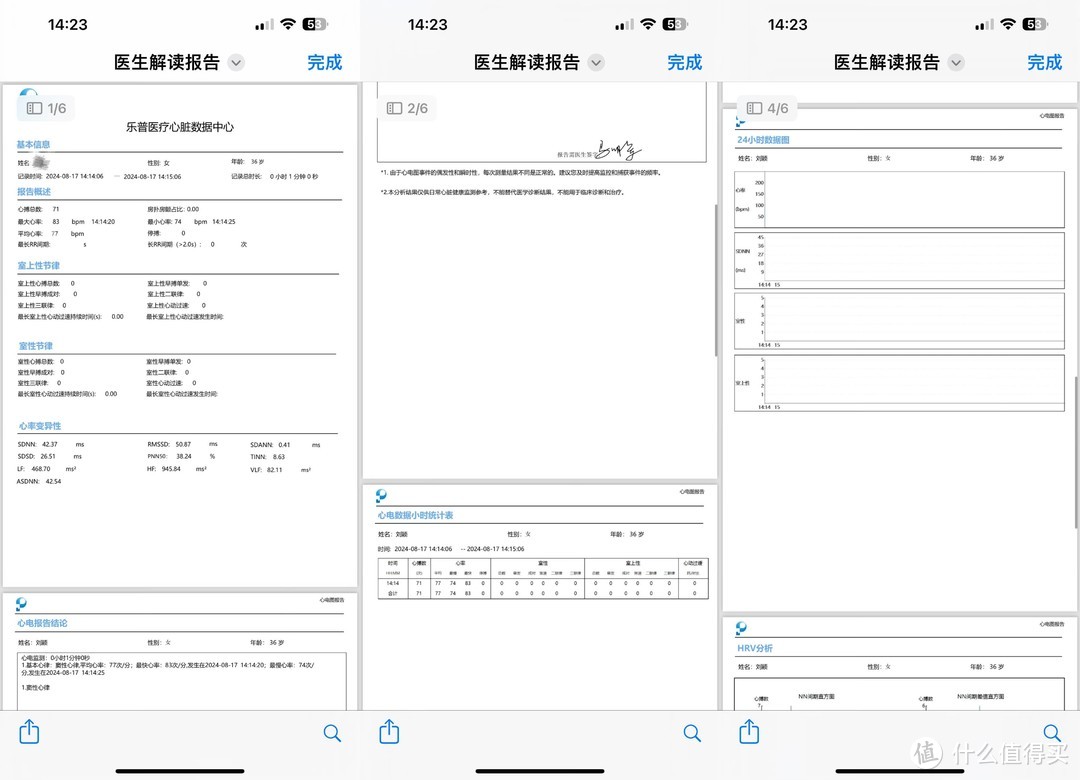 乐普心安宝 ER2-S 屏显版评测：集便携与医用级心电监护于一体，全面提升家庭心脏健康管理水平